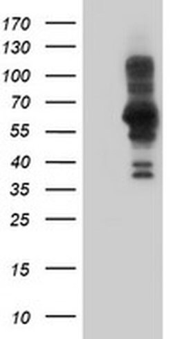 PDLIM5 Monoclonal Antibody (OTI1H10), TrueMAB , OriGene 30 &mu;L; Unconjugated:Antibodies,