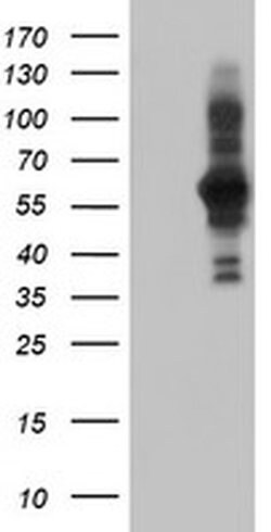 PDLIM5 Monoclonal Antibody (OTI1A11), TrueMAB , OriGene 30 &mu;L | Buy Online | Origene Technologies | Fisher Scientific