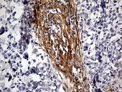 PDPN Mouse anti-Human, Clone: OTI3H5, lyophilized, TrueMAB 100 μg; Unconjugated:Antibodies,