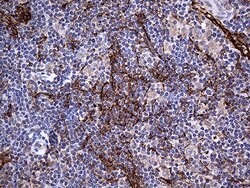 PDPN Mouse anti-Human, Clone: OTI3H5, lyophilized, TrueMAB 100 μg; Unconjugated:Antibodies,