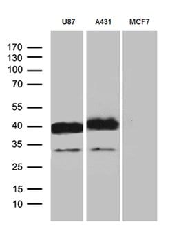 PDPN Mouse anti-Human, Clone: OTI3H5, lyophilized, TrueMAB 100 μg; Unconjugated:Antibodies,