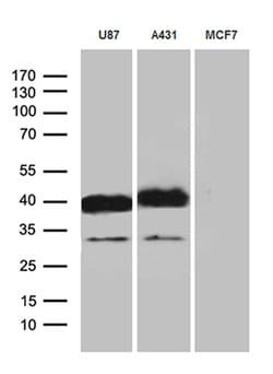 PDPN Monoclonal Antibody (OTI3H5), TrueMAB , OriGene 100 μL; Unconjugated:Antibodies,