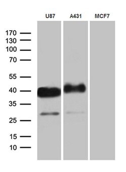 PDPN Monoclonal Antibody (OTI7B4), TrueMAB , OriGene 100 &mu;L; Unconjugated:Antibodies,