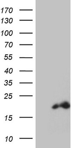 PDRG1 Monoclonal Antibody (OTI1F5), TrueMAB , OriGene 30 &mu;L | Buy Online | Origene Technologies | Fisher Scientific