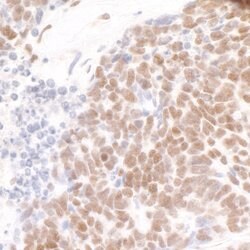 Pds5B Rabbit anti-Human, Mouse, Polyclonal, Bethyl Laboratories 100 &mu;L;