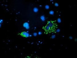 PDSS2 Mouse anti-Human, Clone: OTI1E9, lyophilized, TrueMAB 100 &mu;g;