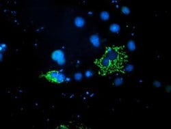 PDSS2 Monoclonal Antibody (OTI1E9), TrueMAB , OriGene 100 &mu;L; Unconjugated:Antibodies,