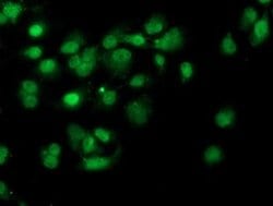 PDSS2 Monoclonal Antibody (OTI1C4), TrueMAB , OriGene 100 &mu;L | Buy Online | Origene Technologies | Fisher Scientific