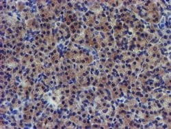 PDSS2 Monoclonal Antibody (OTI1C11), TrueMAB , OriGene 30 &mu;L; Unconjugated:Antibodies,