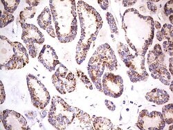 PDSS2 Mouse anti-Human, Clone: UMAB177, liquid, UltraMAB 100 &mu;L; Unconjugated:Antibodies,