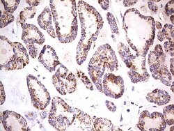 PDSS2 Mouse anti-Human, Clone: UMAB177, lyophilized, UltraMAB 100 &mu;g;