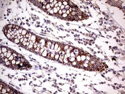 PDSS2 Mouse anti-Human, Clone: UMAB177, liquid, UltraMAB 100 &mu;L; Unconjugated:Antibodies,