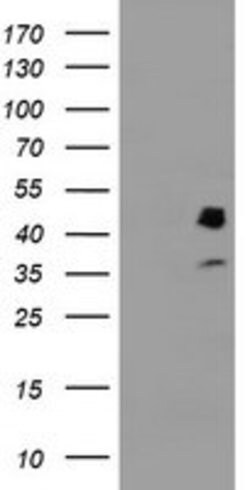 PDSS2 Mouse anti-Human, Clone: OTI1D2, lyophilized, TrueMAB 100 &mu;g | Buy Online | OriGene | Fisher Scientific