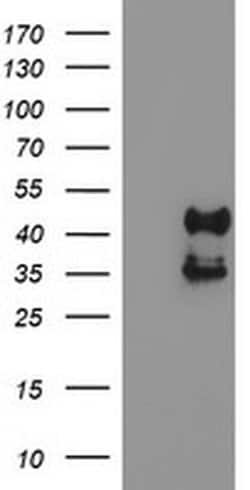 PDSS2 Monoclonal Antibody (OTI1E9), TrueMAB , OriGene 100 &mu;L; Unconjugated:Antibodies,