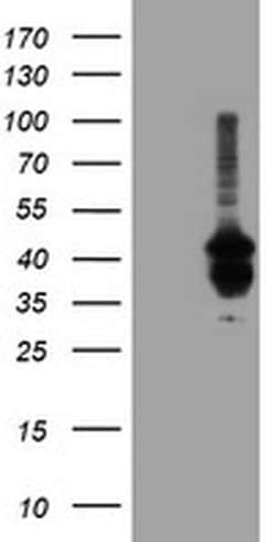 PDSS2 Monoclonal Antibody (OTI1C4), TrueMAB , OriGene 100 &mu;L | Buy Online | Origene Technologies | Fisher Scientific