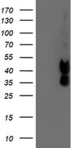 PDSS2 Monoclonal Antibody (OTI1C11), TrueMAB , OriGene:Antibodies:Primary