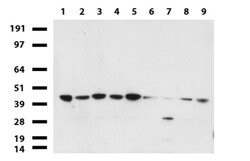 PDSS2 Mouse anti-Human, Clone: UMAB177, liquid, UltraMAB 100 &mu;L; Unconjugated:Antibodies,
