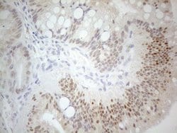 PDX1 Monoclonal Antibody (OTI3H3), TrueMAB , OriGene 100 &mu;L; Unconjugated:Antibodies,