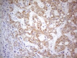 PDX1 Monoclonal Antibody (OTI3H3), TrueMAB , OriGene:Antibodies:Primary