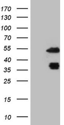PDX1 Monoclonal Antibody (OTI4H7), TrueMAB , OriGene 100 &mu;L; Unconjugated:Antibodies,