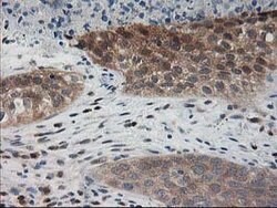 PDXK Mouse anti-Human, Clone: OTI5H5, lyophilized, TrueMAB 100 &mu;g; Unconjugated:Antibodies,