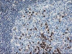 PDXK Mouse anti-Human, Clone: OTI5H5, lyophilized, TrueMAB 100 &mu;g; Unconjugated:Antibodies,