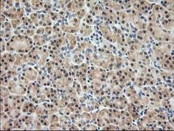 PDXK Monoclonal Antibody (OTI3G2), TrueMAB , OriGene 100 &mu;L; Unconjugated:Antibodies,