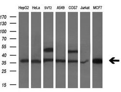 PDXK Mouse anti-Human, Clone: OTI5H5, lyophilized, TrueMAB 100 &mu;g; Unconjugated:Antibodies,