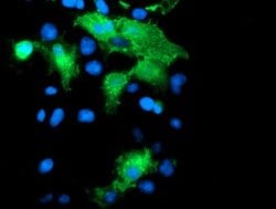 PECAM1 Mouse anti-Human, Clone: OTI4C1, lyophilized, TrueMAB 100 &mu;g;