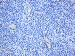 PECAM1 Monoclonal Antibody (OTI1F9), TrueMAB , OriGene 100 &mu;L; Unconjugated:Antibodies,