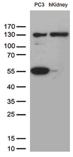 PECAM1 Monoclonal Antibody (OTI1B10), TrueMAB , OriGene 100 &mu;L; Unconjugated:Antibodies,