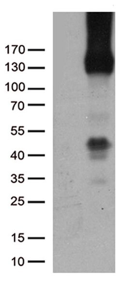 PECAM1 Monoclonal Antibody (OTI1H6), TrueMAB , OriGene 30 &mu;L; Unconjugated:Antibodies,