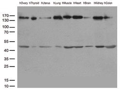 PECAM1 Monoclonal Antibody (OTI1H6), TrueMAB , OriGene:Antibodies:Primary