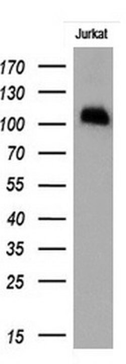 PECAM1 Monoclonal Antibody (OTI3G4), TrueMAB , OriGene 30 &mu;L; Unconjugated:Antibodies,