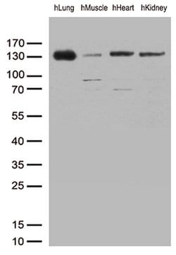 PECAM1 Monoclonal Antibody (OTI1D2), TrueMAB , OriGene 30 &mu;L; Unconjugated:Antibodies,