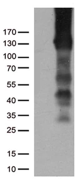 PECAM1 Mouse anti-Human, Clone: UMAB29, liquid, UltraMAB 100 &mu;L; Unconjugated:Antibodies,