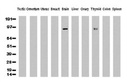 PECAM1 Mouse anti-Human, Clone: UMAB30, liquid, UltraMAB 30 &mu;L; Unconjugated:Antibodies,