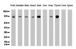 PECAM1 Mouse anti-Human, Clone: UMAB31, liquid, UltraMAB 30 &mu;L | Buy Online | OriGene | Fisher Scientific
