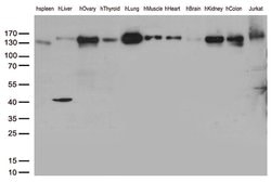 PECAM1 Mouse anti-Human, Clone: UMAB31, liquid, UltraMAB 30 &mu;L | Buy Online | OriGene | Fisher Scientific
