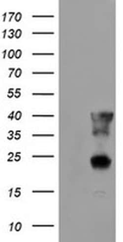 PECI Monoclonal Antibody (OTI1C8), TrueMAB , OriGene 30 &mu;L; Unconjugated:Antibodies,