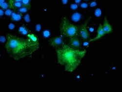 PECR Monoclonal Antibody (OTI1F2), TrueMAB , OriGene:Antibodies:Primary