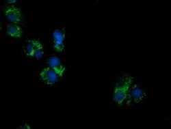 PECR Mouse anti-Human, Clone: OTI1E12, lyophilized, TrueMAB 100 &mu;g;