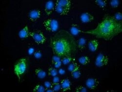 PECR Monoclonal Antibody (OTI1E4), TrueMAB , OriGene 100 &mu;L; Unconjugated:Antibodies,