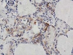 PECR Monoclonal Antibody (OTI2B2), TrueMAB , OriGene 30 &mu;L; Unconjugated:Antibodies,