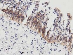 PECR Monoclonal Antibody (OTI2B2), TrueMAB , OriGene 30 &mu;L; Unconjugated:Antibodies,