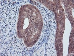 PECR Monoclonal Antibody (OTI1F2), TrueMAB , OriGene 100 &mu;L; Unconjugated:Antibodies,