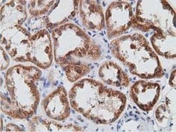 PECR Monoclonal Antibody (OTI1C9), TrueMAB , OriGene 30 &mu;L; Unconjugated:Antibodies,
