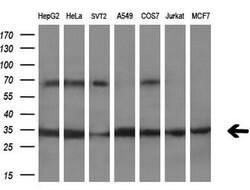 PECR Monoclonal Antibody (OTI1F2), TrueMAB , OriGene 100 &mu;L; Unconjugated:Antibodies,