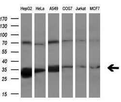 PECR Mouse anti-Human, Clone: OTI1C9, lyophilized, TrueMAB 100 &mu;g; Unconjugated:Antibodies,
