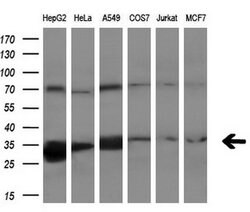 PECR Monoclonal Antibody (OTI1C9), TrueMAB , OriGene 30 &mu;L; Unconjugated:Antibodies,